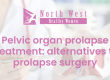 Pelvic Organ prolapse treatment alternatives to prolapse surgery